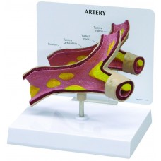 Artery Section Anatomy Model,showing build-up of cholesterol,card and base included
