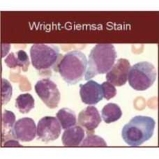 Wright Giemsa Staining solution