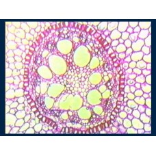 Lilium Root (xs) (Lily) Shows a typcal monocot root.